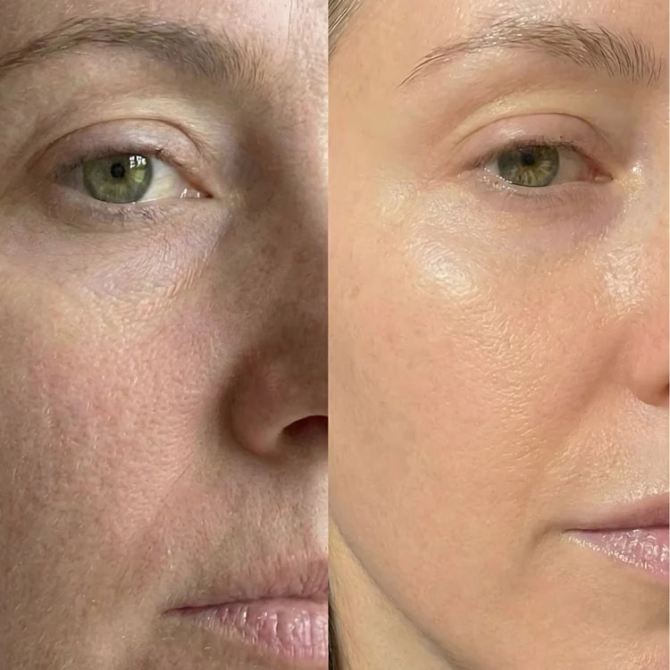 Rachel T. transformation