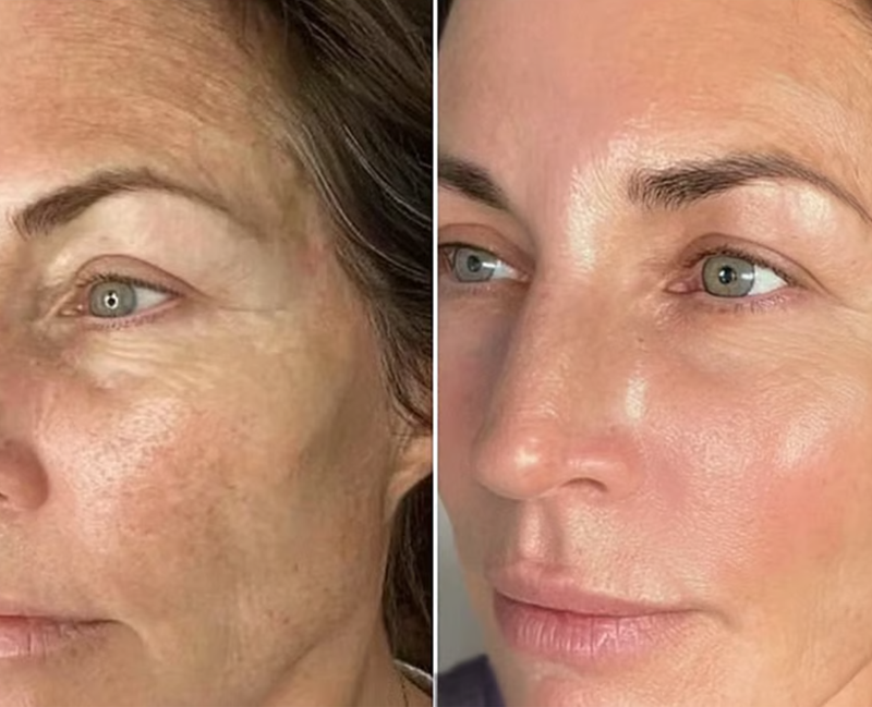 Amanda K. transformation