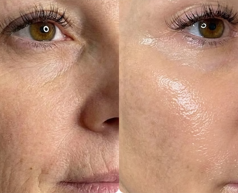 Jessica L. transformation