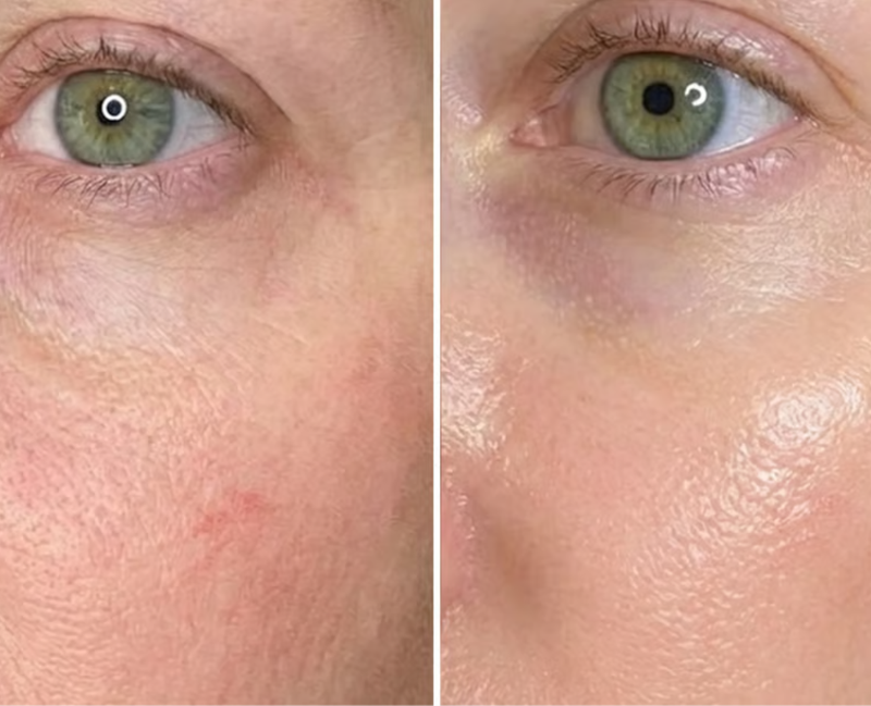 Emily R. transformation