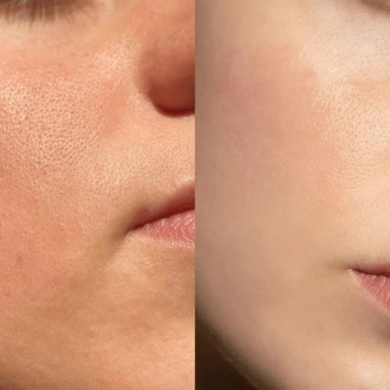 Michelle P. transformation